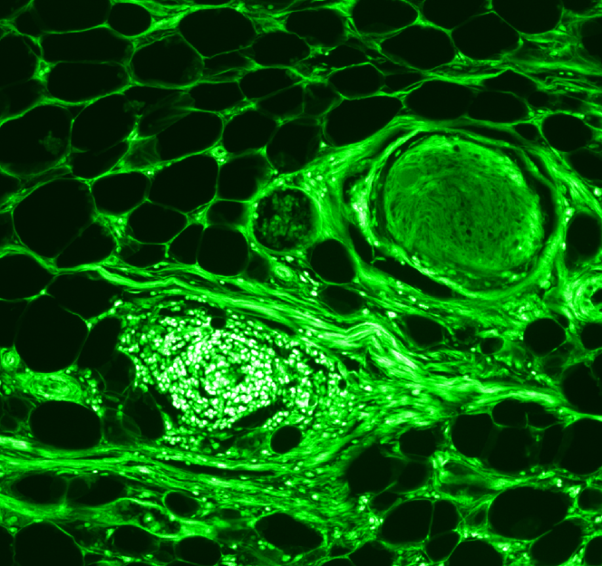 Chloroplasts